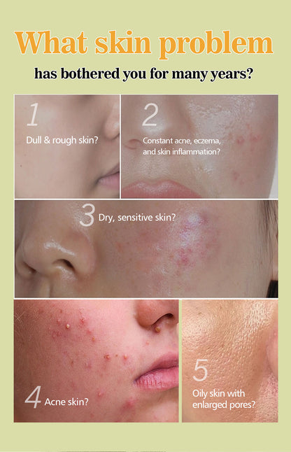 Survey of skin problems with images and text on a light green background